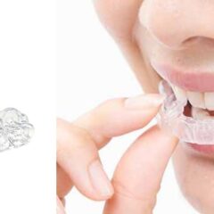 マウスピースの洗浄と保管方法